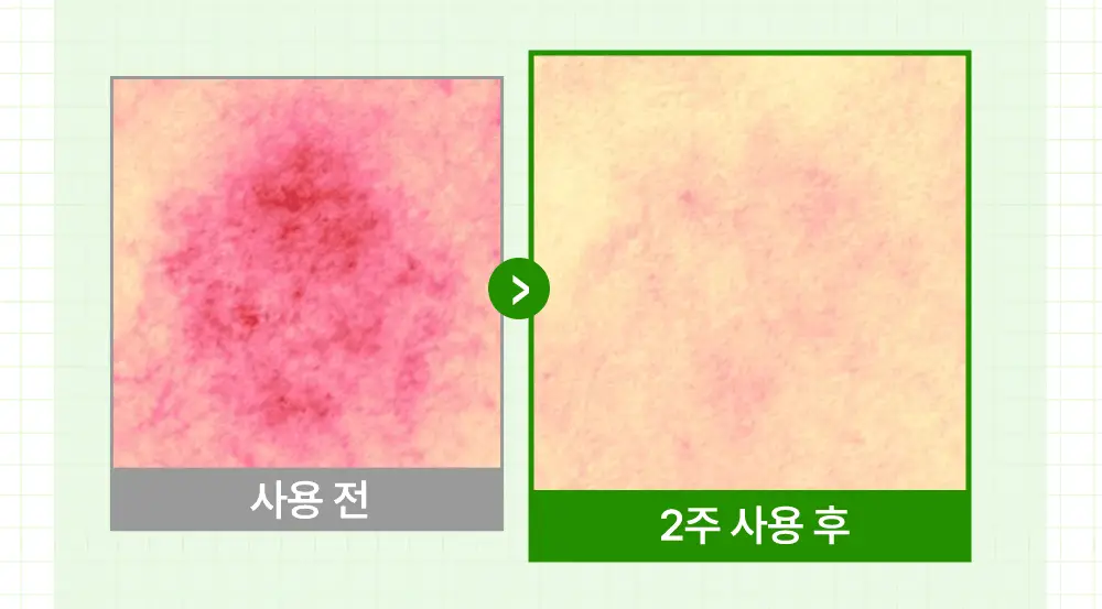[진정크림/총100ml] 웰라쥬 리얼 시카카밍 95 크림 80ml 기획 (+20ml) 상세페이지 12